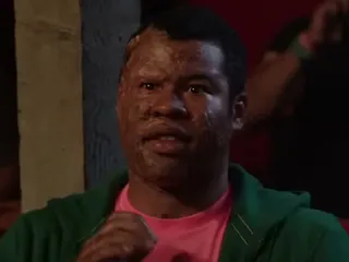 Burn Victim